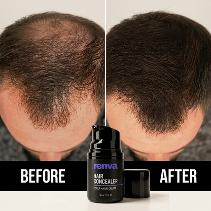 Renva Hair Concealer 30ML